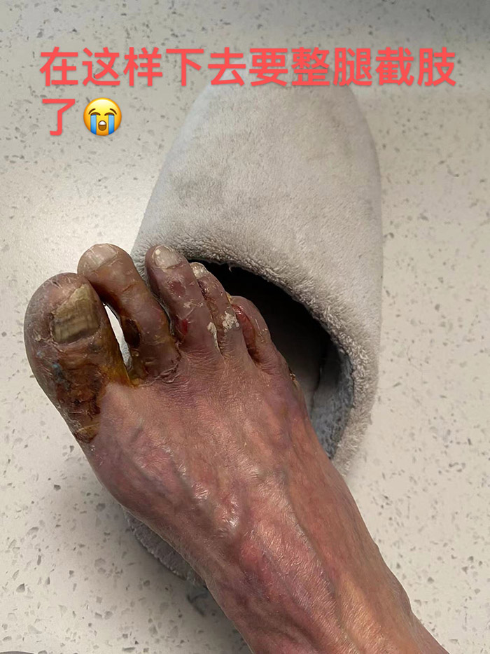 病症照片3