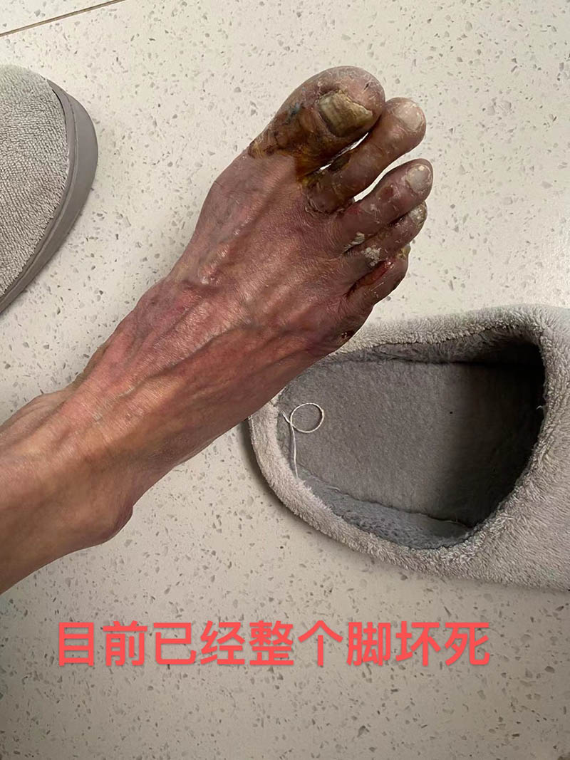 病症照片2