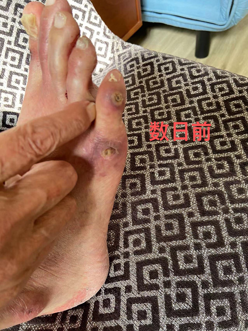 病症照片1